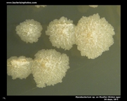 mycobacterium on mueller hinton agar with